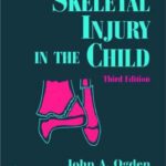 خرید و دانلود نسخه کامل کتاب Skeletal Injury in the Child