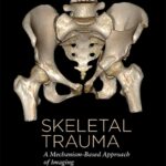 خرید و دانلود نسخه کامل کتاب Skeletal Trauma: A Mechanism-Based Approach of Imaging