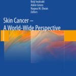 خرید و دانلود نسخه کامل کتاب Skin Cancer – A World-Wide Perspective
