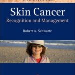 خرید و دانلود نسخه کامل کتاب Skin Cancer: Recognition and Management 2nd Edition