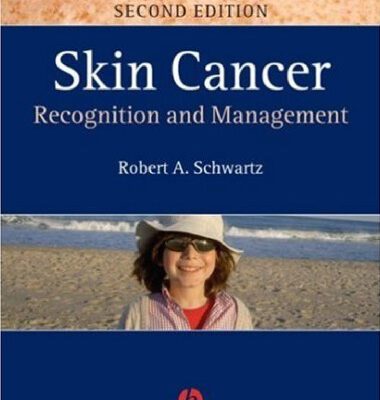 خرید و دانلود نسخه کامل کتاب Skin Cancer: Recognition and Management 2nd Edition