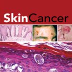 خرید و دانلود نسخه کامل کتاب Skin Cancer