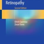 خرید و دانلود نسخه کامل کتاب Small-Gauge Vitrectomy for Diabetic Retinopathy