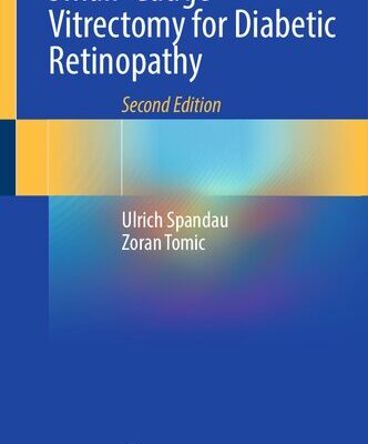 خرید و دانلود نسخه کامل کتاب Small-Gauge Vitrectomy for Diabetic Retinopathy
