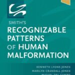 خرید و دانلود نسخه کامل کتاب Smith’s Recognizable Patterns of Human Malformation