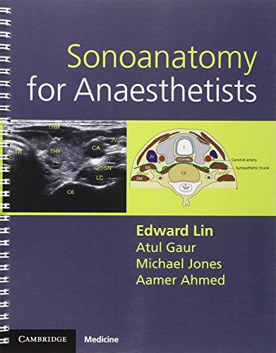 خرید و دانلود نسخه کامل کتاب Sonoanatomy for Anaesthetists_68b9747e1b87d.jpeg خرید و دانلود نسخه کامل کتاب Sonoanatomy for Anaesthetists