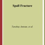 خرید و دانلود نسخه کامل کتاب Spall Fracture