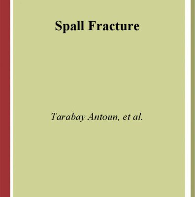 خرید و دانلود نسخه کامل کتاب Spall Fracture