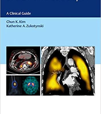 خرید و دانلود نسخه کامل کتاب SPECT and SPECT/CT: A Clinical Guide
