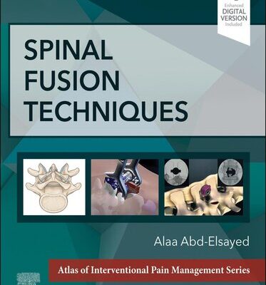 خرید و دانلود نسخه کامل کتاب Spinal Fusion Techniques