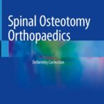 خرید و دانلود نسخه کامل کتاب Spinal Osteotomy Orthopaedics: Deformity Correction