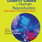 خرید و دانلود نسخه کامل کتاب Stem Cells in Human Reproduction: Basic Science and Therapeutic Potential