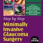 خرید و دانلود نسخه کامل کتاب Step by Step Minimally Invasive Cataract Surgery