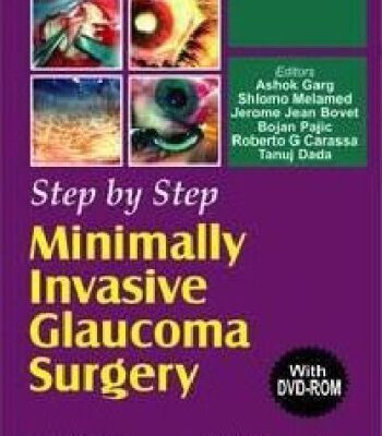 خرید و دانلود نسخه کامل کتاب Step by Step Minimally Invasive Cataract Surgery