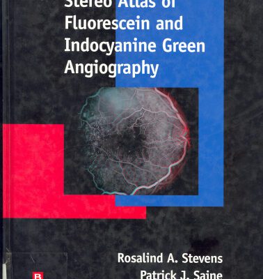 خرید و دانلود نسخه کامل کتاب Stereo atlas of fluorescein and indocyanine green angiography