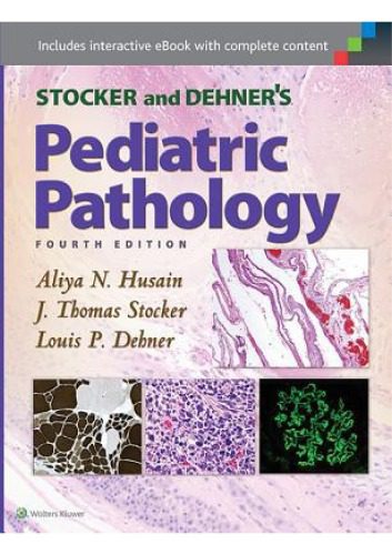 خرید و دانلود نسخه کامل کتاب Stocker and Dehner’s Pediatric Pathology_68d718f33cbfb.jpeg خرید و دانلود نسخه کامل کتاب Stocker and Dehner’s Pediatric Pathology