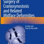 خرید و دانلود نسخه کامل کتاب Surgery of Craniosynostosis and Related Midface Deformities: An Atlas and Step-by-Step Guide