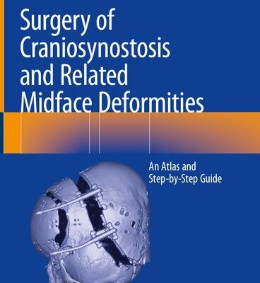 خرید و دانلود نسخه کامل کتاب Surgery of Craniosynostosis and Related Midface Deformities: An Atlas and Step-by-Step Guide