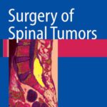 خرید و دانلود نسخه کامل کتاب Surgery of Spinal Tumors
