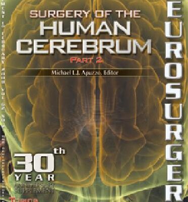 خرید و دانلود نسخه کامل کتاب Surgery of the Human Cerebrum