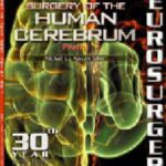 خرید و دانلود نسخه کامل کتاب Surgery of the Human Cerebrum