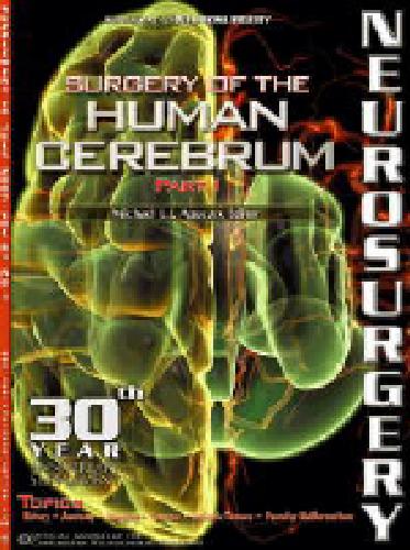خرید و دانلود نسخه کامل کتاب Surgery of the Human Cerebrum_68bc2ad86ece0.jpeg خرید و دانلود نسخه کامل کتاب Surgery of the Human Cerebrum