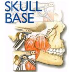خرید و دانلود نسخه کامل کتاب Surgery of the Skull Base