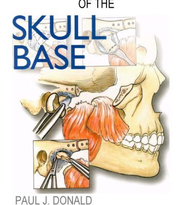 خرید و دانلود نسخه کامل کتاب Surgery of the Skull Base