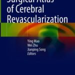 خرید و دانلود نسخه کامل کتاب Surgical Atlas of Cerebral Revascularization