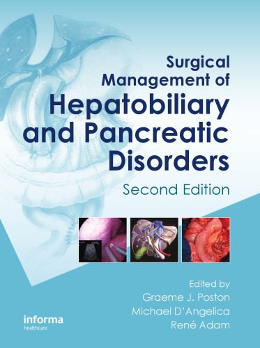 خرید و دانلود نسخه کامل کتاب Surgical Management of Hepatobiliary and Pancreatic Disorders, Second Edition (Oncologysurgery)_68bc3b82a5877.jpeg خرید و دانلود نسخه کامل کتاب Surgical Management of Hepatobiliary and Pancreatic Disorders, Second Edition (Oncologysurgery)