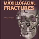 خرید و دانلود نسخه کامل کتاب Surgical Management of Maxillofacial Fractures – Orginal Pdf
