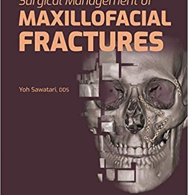 خرید و دانلود نسخه کامل کتاب Surgical Management of Maxillofacial Fractures – Orginal Pdf