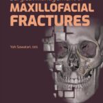 خرید و دانلود نسخه کامل کتاب Surgical Management of Maxillofacial Fractures