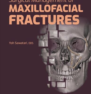 خرید و دانلود نسخه کامل کتاب Surgical Management of Maxillofacial Fractures