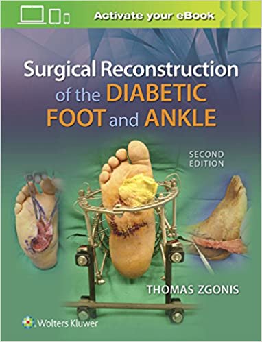 خرید و دانلود نسخه کامل کتاب Surgical Reconstruction of the Diabetic Foot and Ankle (2nd Edition) – + pdf_68b99dfd8fc04.jpeg خرید و دانلود نسخه کامل کتاب Surgical Reconstruction of the Diabetic Foot and Ankle (2nd Edition) – + pdf