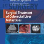 خرید و دانلود نسخه کامل کتاب Surgical Treatment of Colorectal Liver Metastases