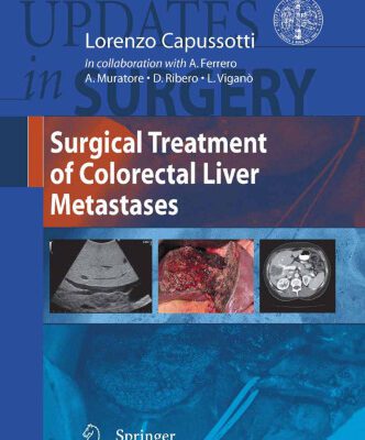خرید و دانلود نسخه کامل کتاب Surgical Treatment of Colorectal Liver Metastases