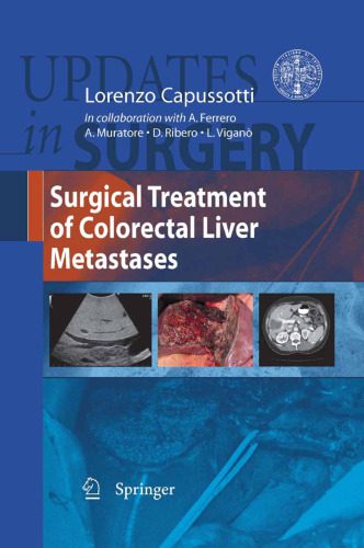 خرید و دانلود نسخه کامل کتاب Surgical Treatment of Colorectal Liver Metastases_68bc5d483eaa2.jpeg خرید و دانلود نسخه کامل کتاب Surgical Treatment of Colorectal Liver Metastases