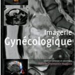 خرید و دانلود نسخه کامل کتاب Syllabus Imagerie Gynécologique