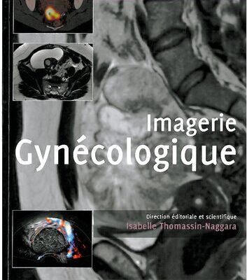 خرید و دانلود نسخه کامل کتاب Syllabus Imagerie Gynécologique