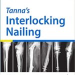 خرید و دانلود نسخه کامل کتاب Tanna’s Interlocking Nailing (4th Edition) – Original PDF