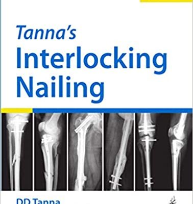 خرید و دانلود نسخه کامل کتاب Tanna’s Interlocking Nailing (4th Edition) – Original PDF