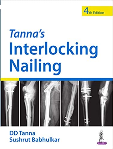 خرید و دانلود نسخه کامل کتاب Tanna’s Interlocking Nailing (4th Edition) – Original PDF_68b971516986b.jpeg خرید و دانلود نسخه کامل کتاب Tanna’s Interlocking Nailing (4th Edition) – Original PDF