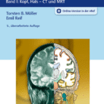 خرید و دانلود نسخه کامل کتاب Taschenatlas Schnittbildanatomie  Band I: Kopf, Hals – CT und MRT  5., überarbeitete Auflage  312 Abbildungen – Original PDF