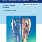 خرید و دانلود نسخه کامل کتاب Taschenatlas Schnittbildanatomie  Band III: Extremitäten, Gelenke, Wirbelsäule – CT und MRT  2., überarbeitete Auflage  446 Abbildungen – Original PDF