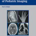 خرید و دانلود نسخه کامل کتاب Teaching Atlas of Pediatric Imaging (Teaching Atlas Series)