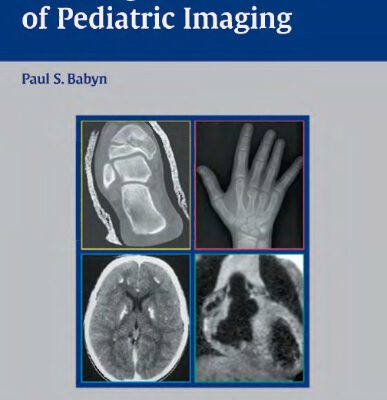 خرید و دانلود نسخه کامل کتاب Teaching Atlas of Pediatric Imaging (Teaching Atlas Series)