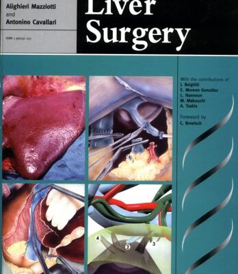 خرید و دانلود نسخه کامل کتاب Techniques in Liver Surgery