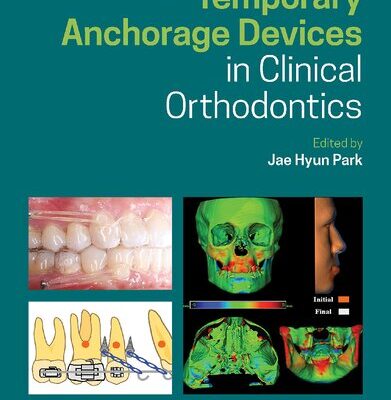 خرید و دانلود نسخه کامل کتاب Temporary Anchorage Devices in Clinical Orthodontics