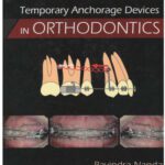 خرید و دانلود نسخه کامل کتاب Temporary Anchorage Devices in Orthodontics